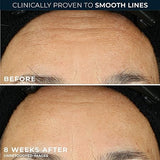 RoC Retinol Correxion Line Smoothing Night Serum, 30 Capsules